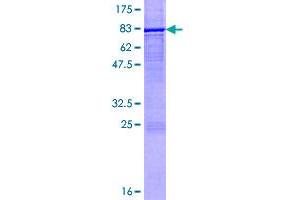 Image no. 1 for Cytochrome P450, Family 2, Subfamily E, Polypeptide 1 (CYP2E1) (AA 1-493) protein (GST tag) (ABIN1350976) (CYP2E1 Protein (AA 1-493) (GST tag))