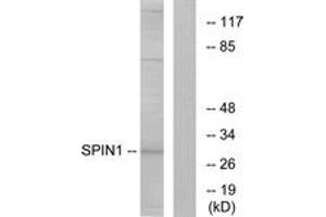 Western blot analysis of extracts from HeLa cells, using SPIN1 Antibody. (Spindlin 1 Antikörper  (AA 111-160))