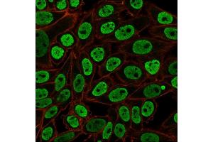 Immunofluorescent staining of paraformaldehyde-fixed HeLa cells with Pan-Nuclear Antigen Monoclonal Antibody (NM106) followed by goat anti-Mouse IgG-CF488 (Green). (Nuclear Antigen (Pan-Nuclear Marker) Antikörper)
