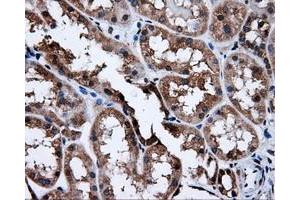 Immunohistochemical staining of paraffin-embedded Kidney tissue using anti-SATB1mouse monoclonal antibody. (SATB1 Antikörper)