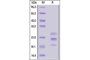 SDS-PAGE (SDS) image for Interleukin 17A (IL17A) (AA 24-155) (Active) protein (His tag) (ABIN7013505)