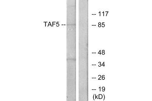 Western Blotting (WB) image for anti-TAF5 RNA Polymerase II, TATA Box Binding Protein (TBP)-Associated Factor, 100kDa (TAF5) (Internal Region) antibody (ABIN1849630) (TAF5 Antikörper  (Internal Region))