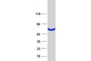 Western Blotting (WB) image for Phosphatidylinositol-5-Phosphate 4-Kinase, Type II, alpha (PIP4K2A) protein (Myc-DYKDDDDK Tag) (ABIN2729005)
