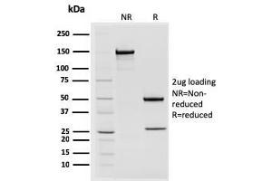 SDS-PAGE Analysis Purified STAT2 Mouse Monoclonal Antibody (STAT2/2650). (STAT2 Antikörper)