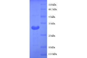 SDS-PAGE (SDS) image for Metallothionein 1G (MT1G) (AA 1-59), (partial) protein (GST tag) (ABIN4974716)