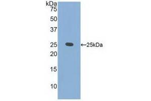 Western blot analysis of recombinant Human CRADD. (CRADD Antikörper  (AA 1-199))