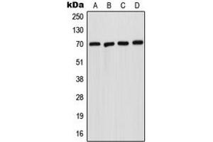 Western blot analysis of Acid Sphingomyelinase expression in A431 (A), HepG2 (B), SP2/0 (C), H9C2 (D) whole cell lysates.