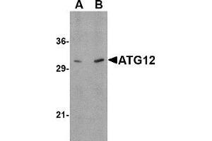 Western blot: ATG12 antibody staining of Human brain tissue lysate at (A) 0. (ATG12 Antikörper  (N-Term))