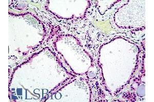PTPN22 Antikörper  (Internal Region)