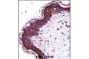 S100A7 Antibody (N-term) ((ABIN657716 and ABIN2846704))immunohistochemistry analysis in formalin fixed and paraffin embedded human skin tissue followed by peroxidase conjugation of the secondary antibody and DAB staining. (S100A7 Antikörper  (N-Term))