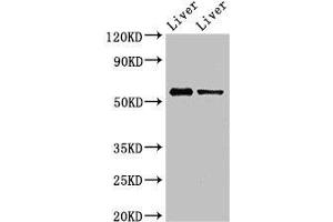 Western Blot Positive WB detected in: Mouse liver tissue, Rat liver tissue All lanes: ETV1 antibody at 3 μg/mL Secondary Goat polyclonal to rabbit IgG at 1/50000 dilution Predicted band size: 56, 54, 53, 44, 49, 51 kDa Observed band size: 56 kDa (ETV1 Antikörper  (AA 61-332))
