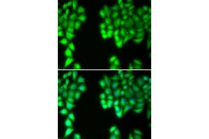Immunofluorescence analysis of U20S cell using MALT1 antibody. (MALT1 Antikörper  (AA 125-450))
