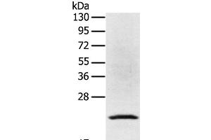 Western Blot analysis of Jurkat cell using TP53I11 Polyclonal Antibody at dilution of 1:400 (TP53I11 Antikörper)