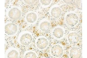 ABIN6260943 and ABIN6266830 at 1/100 staining human normal colon tissue by IHC-P.