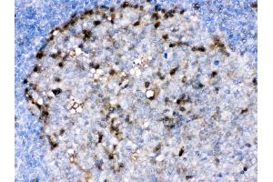 Immunohistochemistry (IHC) image for anti-Adenosine Deaminase (ADA) (AA 135-363) antibody (ABIN4886424)