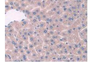 IHC-P analysis of Mouse Liver Tissue, with DAB staining. (TPP1 Antikörper  (AA 198-562))