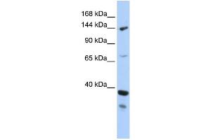 WB Suggested Anti-DHX37 Antibody Titration:  0. (DHX37 Antikörper  (N-Term))