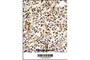 Formalin-fixed and paraffin-embedded human lymph reacted with PCM-1 Antibody , which was peroxidase-conjugated to the secondary antibody, followed by DAB staining. (PCM1 Antikörper  (C-Term))