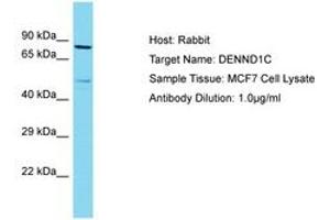 Image no. 1 for anti-DENN/MADD Domain Containing 1C (DENND1C) (C-Term) antibody (ABIN6750558) (DENND1C Antikörper  (C-Term))