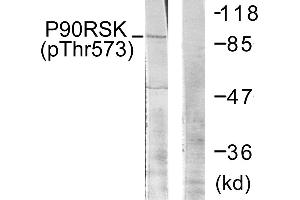 Western blot analysis of extracts from 293 cells, treated with UV (30 mins), using p90 RSK (Phospho-Thr573) antibody. (RPS6KA3 Antikörper  (pThr573))