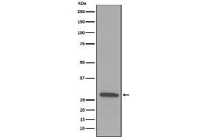 Western blot analysis of C1QB expression in Human plasma lysate.