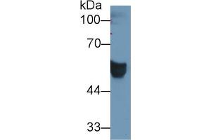 Western blot analysis of Human Serum, using Human CEACAM1 Antibody (1 µg/ml) and HRP-conjugated Goat Anti-Rabbit antibody ( (CEACAM1 Antikörper  (AA 35-320))
