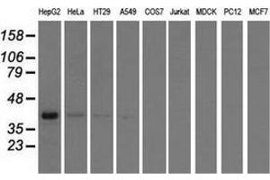 Western blot analysis of extracts (35 µg) from 9 different cell lines by using anti-HIBCH monoclonal antibody.