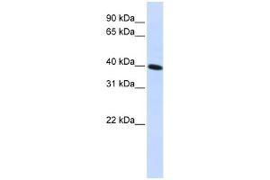 WB Suggested Anti-CARKD Antibody Titration:  0. (Carkd Antikörper  (Middle Region))