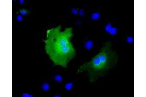 Anti-KBTBD7 mouse monoclonal antibody (ABIN2453189) immunofluorescent staining of COS7 cells transiently transfected by pCMV6-ENTRY KBTBD7 (RC205559). (KBTBD7 Antikörper)