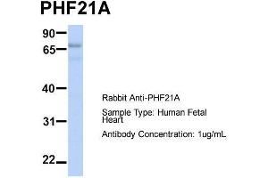 Host:  Rabbit  Target Name:  PHF21A  Sample Type:  Human Fetal Heart  Antibody Dilution:  1. (PHF21A Antikörper  (N-Term))