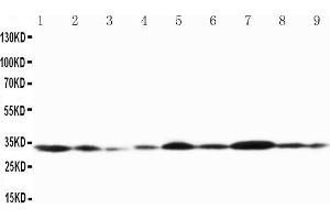 Western Blotting (WB) image for anti-Gap Junction Protein, beta 1, 32kDa (GJB1) (AA 215-231), (Middle Region) antibody (ABIN3042611)