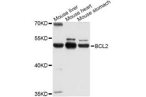 Western blot analysis of extracts of various cell lines, using POU2F3 Antibody (ABIN4904821) at 1:1000 dilution. (POU2F3 Antikörper)