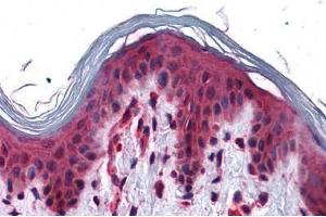 Human Skin: Formalin-Fixed, Paraffin-Embedded (FFPE) (SLC5A6 Antikörper  (Internal Region))