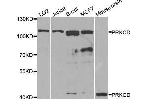 Western blot analysis of extracts of various cell lines, using PRKCD antibody. (PKC delta Antikörper)