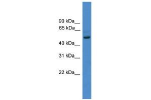 WB Suggested Anti-ZNF277 Antibody Titration:  0. (ZNF277 Antikörper  (N-Term))