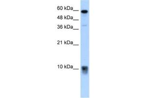 Western Blotting (WB) image for anti-S100 Calcium Binding Protein A3 (S100A3) antibody (ABIN2462524) (S100A3 Antikörper)