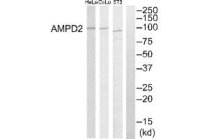 Western blot analysis of extracts from HeLa cells, NIH-3T3 cells and COLO205 cells, using AMPD2 antibody. (AMPD2 Antikörper)