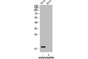 Western Blot analysis of hela using Acetyl-Histone H3 (K9) Polyclonal Antibody. (HIST1H3A/HIST2H3A/H3F3A (acLys9) Antikörper)