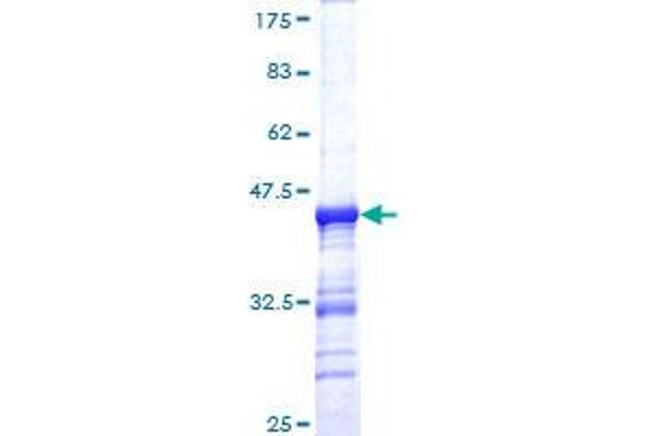 PTH1R Protein (AA 27-134) (GST tag)