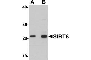 Western blot analysis of SIRT6 in HeLa cell lysate with SIRT6 antibody at (A) 0. (SIRT6 Antikörper  (C-Term))