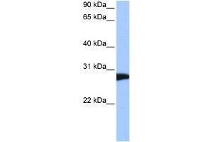 WB Suggested Anti-NSF Antibody Titration:  0. (NSF Antikörper  (C-Term))