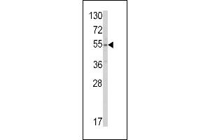 Western blot analysis of SLC38A3 Antibody (Center) (ABIN390795 and ABIN2841042) in HepG2 cell line lysates (35 μg/lane). (SLC38A3 Antikörper  (AA 442-468))