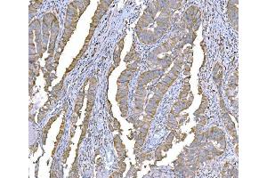 IHC analysis of SND1 using anti-SND1 antibody (ABIN7600526). (SND1 Antikörper  (AA 20-204))