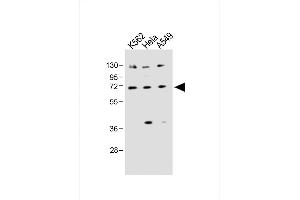All lanes : Anti-SLC22A4 Antibody (C-term) at 1:1000 dilution Lane 1: K562 whole cell lysate Lane 2: Hela whole cell lysate Lane 3: A549 whole cell lysate Lysates/proteins at 20 μg per lane. (SLC22A4 Antikörper  (C-Term))