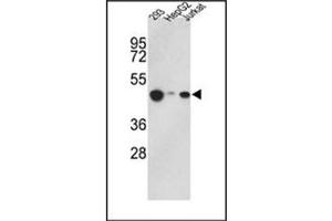 Image no. 1 for anti-Histone Acetyltransferase 1 (HAT1) (AA 390-419), (C-Term) antibody (ABIN356621) (HAT1 Antikörper  (C-Term))