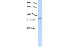 WB Suggested Anti-CA4 Antibody Titration:  0. (CA4 Antikörper  (C-Term))