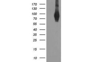 Western Blotting (WB) image for anti-phosphodiesterase 4B, cAMP-Specific (PDE4B) antibody (ABIN1500093) (PDE4B Antikörper)