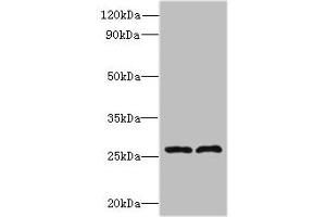Western blot All lanes: FAM71C antibody at 6 μg/mL Lane 1: 293T whole cell lysate Lane 2: Jurkat whole cell lysate Secondary Goat polyclonal to rabbit IgG at 1/10000 dilution Predicted band size: 28 kDa Observed band size: 28 kDa (FAM71C Antikörper  (AA 1-241))
