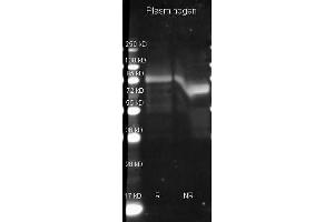 Goat anti Plasminogen antibody  was used to detect Plasminogen under reducing (R) and non-reducing (NR) conditions. (PLG Antikörper)