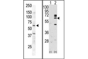 Image no. 2 for anti-RYK Receptor-Like Tyrosine Kinase (RYK) (AA 150-200) antibody (ABIN359937) (RYK Antikörper  (AA 150-200))